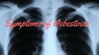 Symptoms of Asbestosis