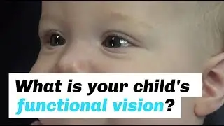 Does Your Child have Functional Vision