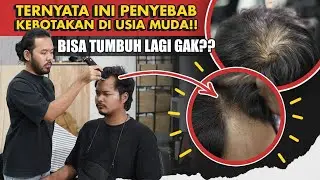 Masih Muda Kok Rambut Mulai TIPIS? Begini Cara Mengatasinya…