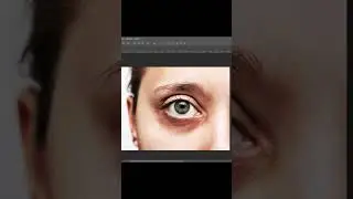 Photoshop İpuçları - Göz Altı Halkalarını Yok Etme ( Photoshop Tips-How to Remove Under Eye Circles)