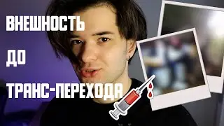 Мои фото до гормонотерапии! FtM / ФтМ