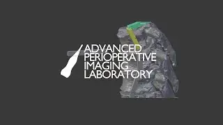 Animated Spine Deformation [BLENDER]