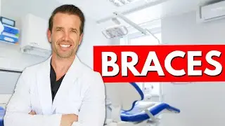 Braces