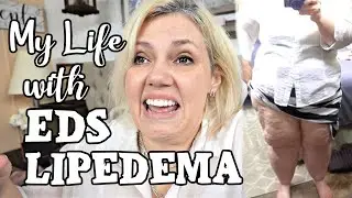 The Danger of Feeling Good - My Body With Lipedema and EDS