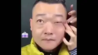 ลดริ้วรอยทันที กระชับบใบหน้ารูปตัว V