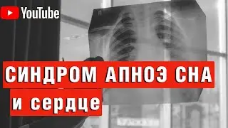 АПНОЭ СНА и влияние на сердце