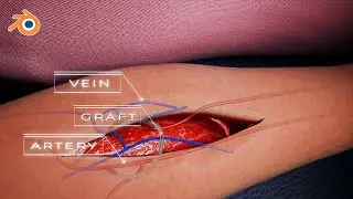 Blender science animation - Hemodialysis