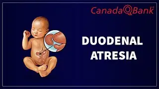 Duodenal Atresia