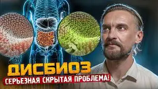 СИМПТОМЫ ДИСБИОЗА: КАК РАСПОЗНАТЬ И ЛЕЧИТЬ СЕРЬЕЗНУЮ ПРОБЛЕМУ?