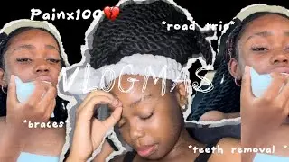 GETTING BRACES VLOG!!!| vlogmas ❤️*painx100*