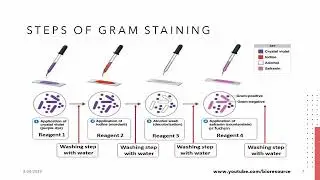 Gram Staining: A Microbial Detective Tool | Exploring Bacterial Cell Walls