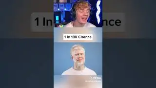 The Rarest Human Genetics in the World! 😱
