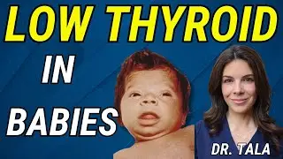 Doctor reviews: Symptoms, Labs and Treatment of CONGENITAL Hypothyroidism