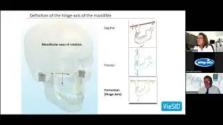 CADIAX Webinar – Part 1 (Nov 3, 2023)