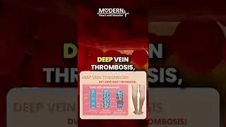 Varicose Veins: Symptoms & Risks