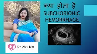 क्या होता है SUBCHORIONIC HEMORRHAGE IN PREGNANCY (HINDI)