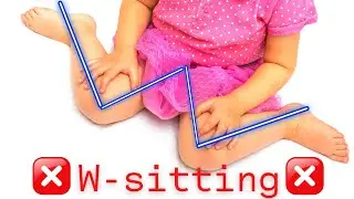 DON'T LET YOUR BABY SIT LIKE THAT! W-SITTING DANGERS ⛔