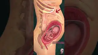 Pregnancy 💞 & intestines in 17 sec.🥹