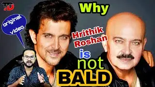 आखिर क्यु Hrithik Roshan गंजे नहीं हुए। original video 😎। HAIR TRANSPLANT।CASE STUDY ।#TANNUDADA