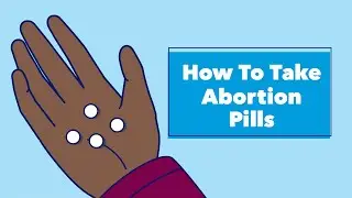 How to Take Abortion Pills | Planned Parenthood Video