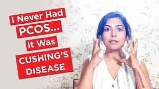 I Never Had PCOS... It Was Cushings Disease / Cushings Syndrome #cushing