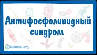 Антифосфолипидный синдром (АФС) — причины, симптомы, патогенез, диагностика, лечение