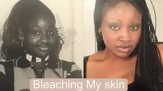 My Skin Bleaching story! An African Horror Story