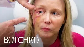 2 MAJOR Predatory Procedure Makeovers on Botched | E!