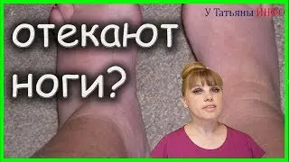 Твои НОГИ болят и отекают? Что делать, когда отекают ноги?