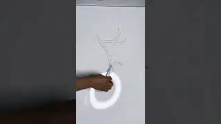 Как вылечить инсульт