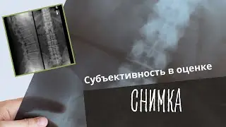 Субъективность в оценке снимка, погрешность измерения