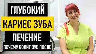 Глубокий кариес: симптомы и лечение глубокого кариеса. Почему ноет и болит зуб после лечения