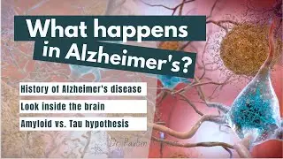 What happens to the brain in Alzheimers disease? | Amyloid & Tau explained