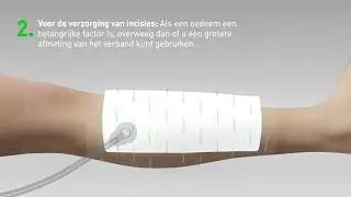 Avance Solo - Meerlaags verband