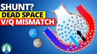 Shunt vs. Dead Space vs. V/Q Mismatch | EXPLAINED