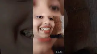 My Braces journey/BRACES TRANSFORMATION VIDEO 