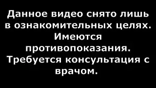 🔴 Как я вылечил кашель после ОРВИ ингаляцией прополисом 🔴