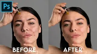 High end Skin Retouching - Photoshop tutorial #photoshoptutorial #photoshop