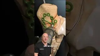 Most Painful Broken Bone⁉️ #shorts