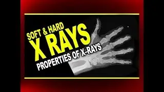 Soft and Hard X–Rays and Properties of X–Rays | Physics4students