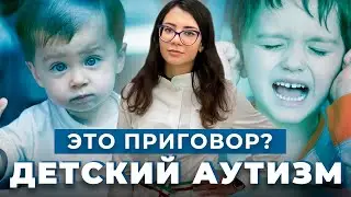 АУТИЗМ: причины, признаки, симптомы | Лечение АУТИЗМА у детей | Как распознать аутизм у ребенка?