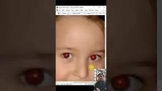 Remove Red Eye 