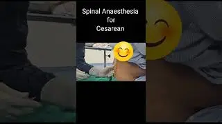 सीजेरियन में कमर में सुई लगाकर कैसे बेहोश करते हैं / Spinal Anaesthesia by Dr Manoj Kathariya