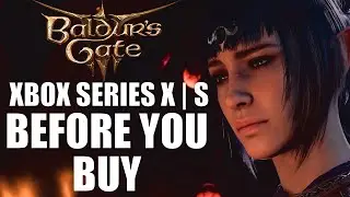 Baldurs Gate 3 Xbox Series X | S - 15 Things You Need To Know Before You Buy