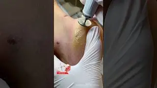ДУМАЛА КОЖА РЕЗИНОВАЯ #аленалаврентьева #shortsvideo #пододиск #nipponnippers #подолог #подология