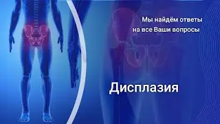 Дисплазия
