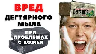 99% людей не знают про вред дегтярного мыла при проблемах с кожей