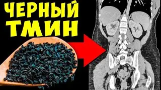 Вот что Творит обычный Чёрный Тмин, если Есть его Каждый день