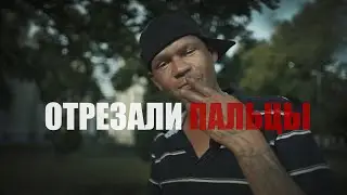 ПРОПИЛ ПАЛЬЦЫ, НЕ ПОМНЮ ГДЕ