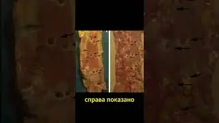 Найдена причина боли в пояснице! Доктор Майкл Грегер #наука #наука #поясница  #спина  #боль в спине